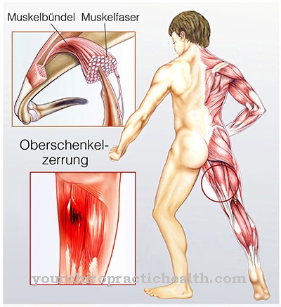 Fatigue musculaire