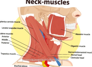 Muscular torticollis (torticollis muscularis)