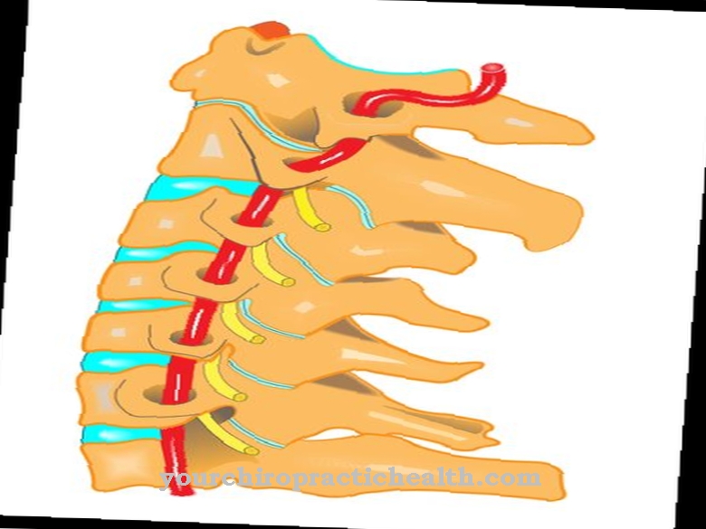 Myelopathy