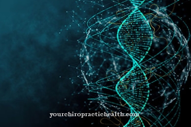 Type 1 myotonic dystrophy