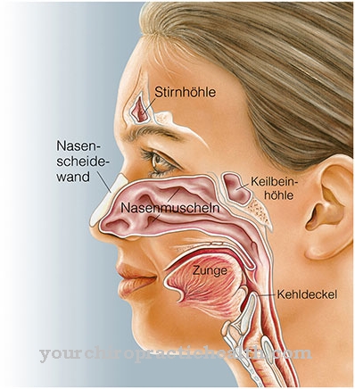 Sinus mucocele