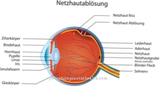 Retinal detachment