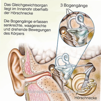 Vestibularis neuritis