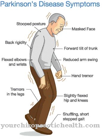 Neurodegeneratiivsed haigused