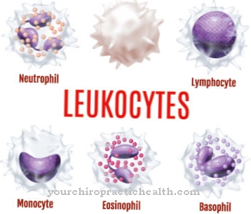 Neutrophilia