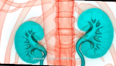 Kidney infarction