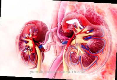 renal colic