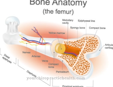 Femoral neck fracture (femoral neck fracture)