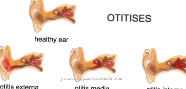 Öroninfektion