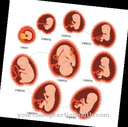 Oligohydramnios sequence