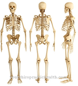 Osteochondroma