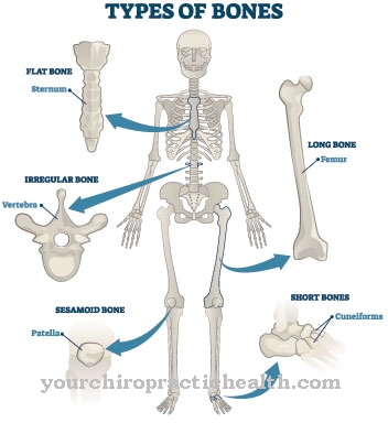 Osteonecrose