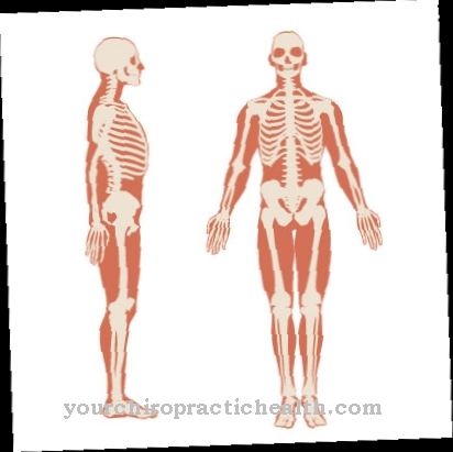 Osteoonychodysplasia