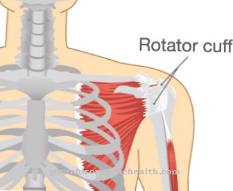 Osteofit