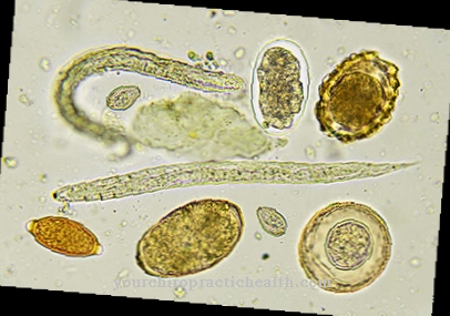 Oxyuriasis