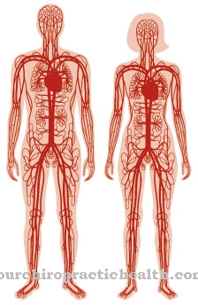 Panarteritis nodosa