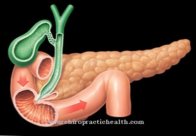 Pancreatic cyst