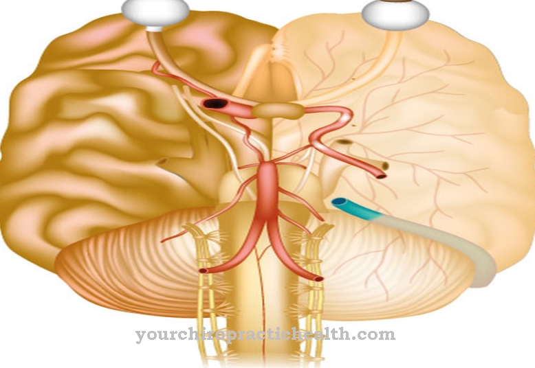 Paraganglioma