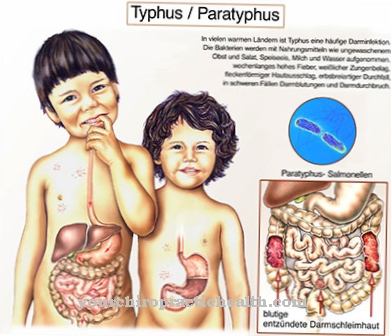 Paratyphoid