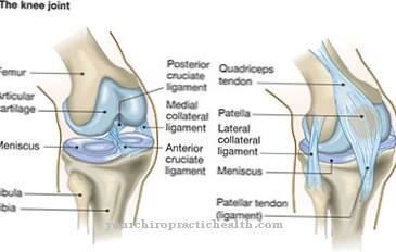 Patellar dysplasia