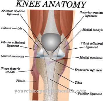 Patellar luxation