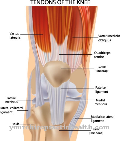 Patellas cīpslas plīsums