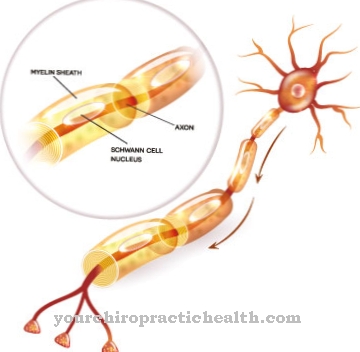 Pelizaeus-Merzbacher disease