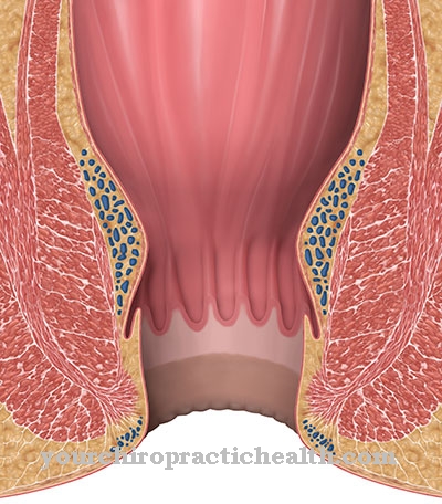 Perianal thrombosis