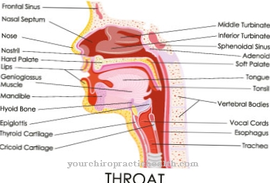 Peritonsillar abscess