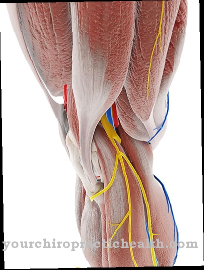 Peroneal palsy