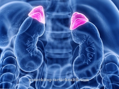 Pheochromocytoma