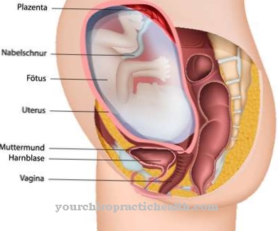 Placental insufficiens