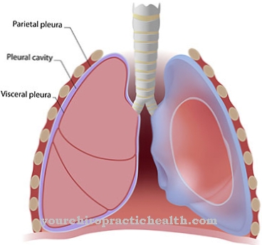 Pleural mesothelioma