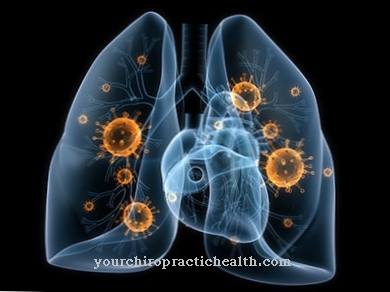 Pneumocystis pneumonia