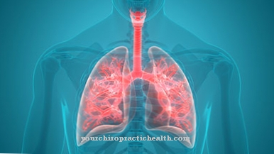 Pneumoconiosis