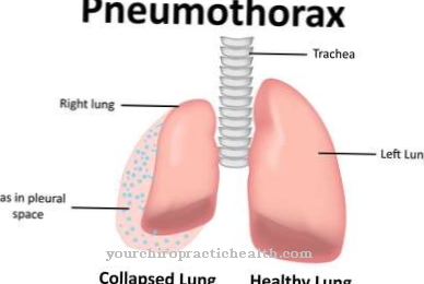 Pneumotooraks