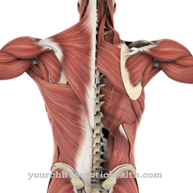 Polymyositis