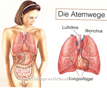 Pierwotna dyskinezy rzęsek