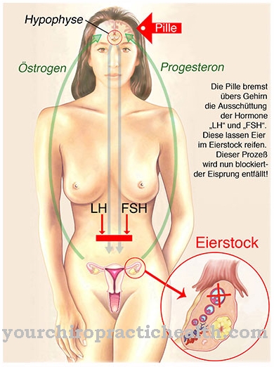 Progesterone deficiency