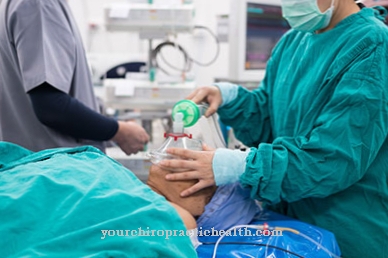 Propofol जलसेक सिंड्रोम