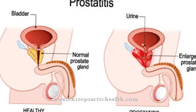 Prostatas iekaisums (prostatīts)