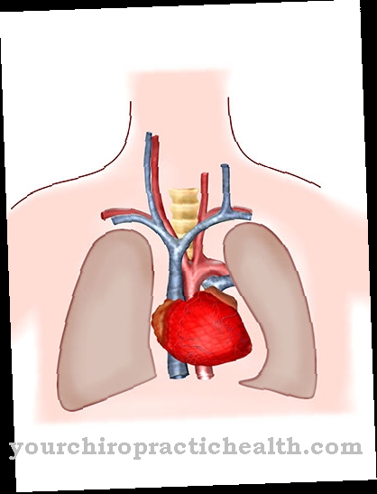 Pulmonale hypertensie