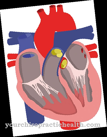 Régurgitation valvulaire pulmonaire