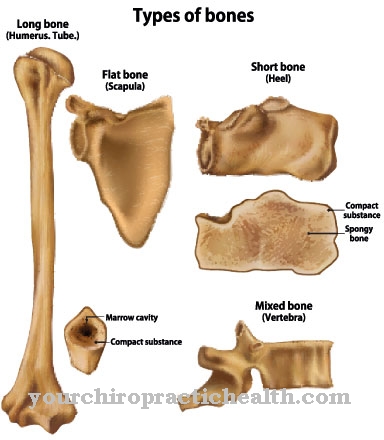 Pyle syndrome