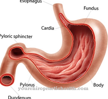 Stenosi pilorica (restringimento della porta dello stomaco)