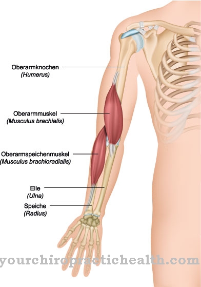 Radius fractuur (gebroken spaak)