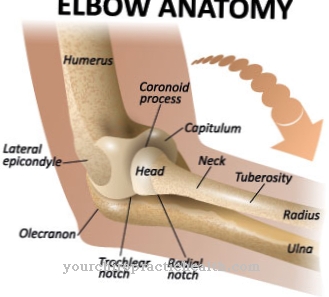 Fracture of the radial head