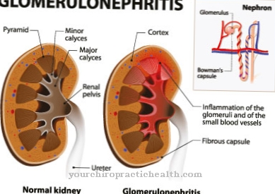 Rychle progresivní glomerulonefritida