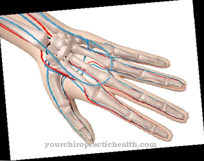 Raynauds syndrom