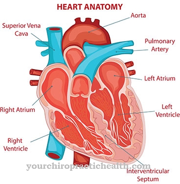 Right ventricular hypertrophy